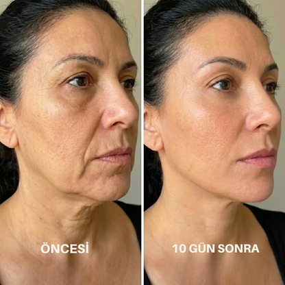VYORA™ Gıdı ve Kırışıklık Giderici Yüz Bakım Sargı Maskesi