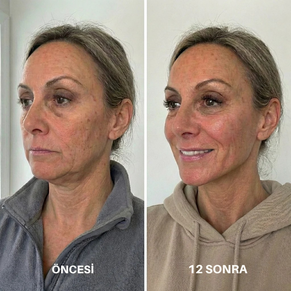 VYORA™ Gıdı ve Kırışıklık Giderici Yüz Bakım Sargı Maskesi