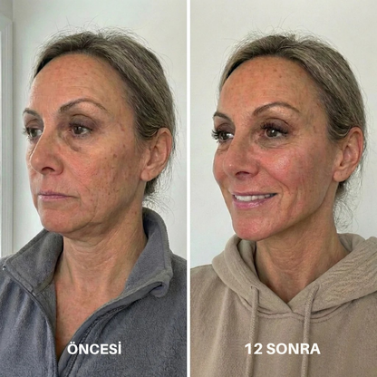 VYORA™ Gıdı ve Kırışıklık Giderici Yüz Bakım Sargı Maskesi